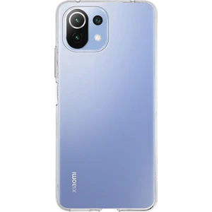 Case World Xiaomi Mi 11 Lite ile Uyumlu Kapak 1mm Şeffaf Silikon ile Uyumlu Kılıf