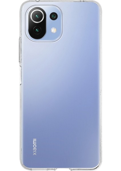 Xiaomi Mi 11 Lite ile Uyumlu Kapak 1mm Şeffaf Silikon ile Uyumlu Kılıf