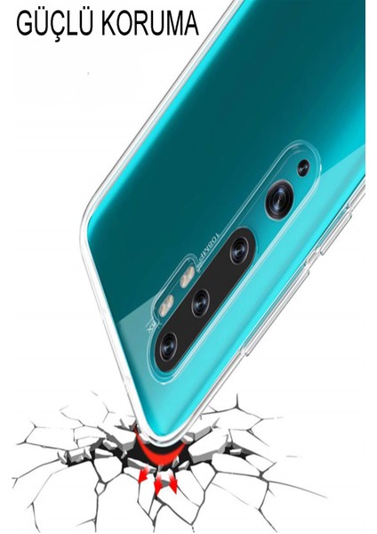 Xiaomi Redmi Note 4 Kapak 1mm Şeffaf Silikon Kılıf