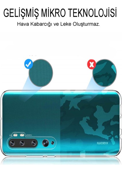 Xiaomi Mi Note 2 Kapak 1mm Şeffaf Silikon Kılıf