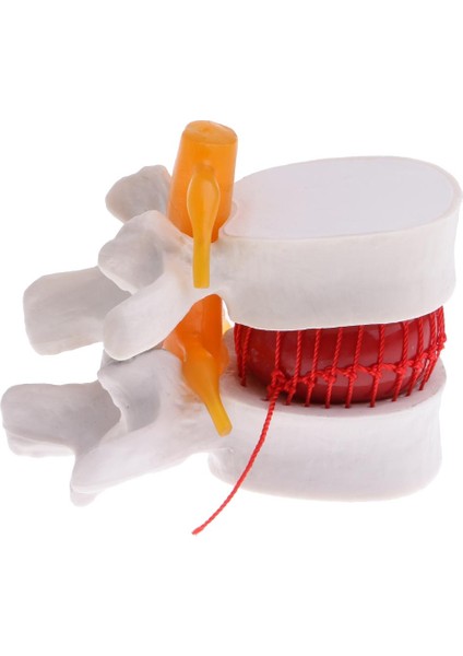 Insan Heykeli Modeli Lomber Intervertebral Omurga Tedarik Süsleme Laboratio Pvc (Yurt Dışından)