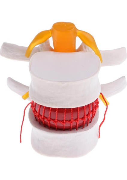 Insan Heykeli Modeli Lomber Intervertebral Omurga Tedarik Süsleme Laboratio Pvc (Yurt Dışından)