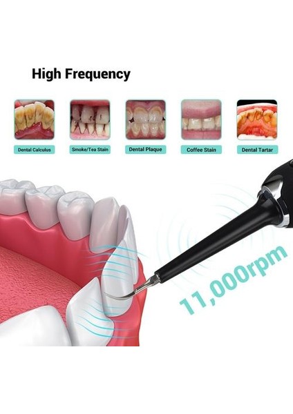 Elektrik 7in1 Diş Scaler Titreşim Diş Hesap Sökücü Sonic Yüksek Frekanslı  Tartar Diş Fırçası Temizleyici Taşınabilir (Yurt Dışından)