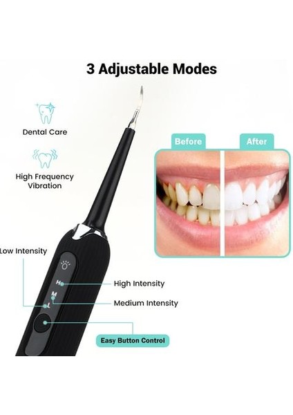 Elektrik 7in1 Diş Scaler Titreşim Diş Hesap Sökücü Sonic Yüksek Frekanslı  Tartar Diş Fırçası Temizleyici Taşınabilir (Yurt Dışından)