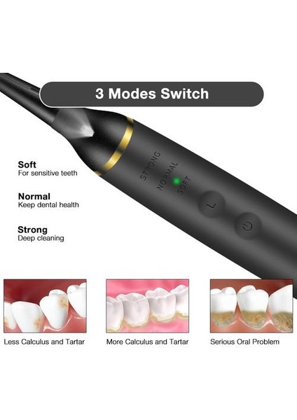 Sonic Elektrikli Diş Tartar Sökücü Diş Scaler Diş Leke Temizleme (Yurt Dışından)