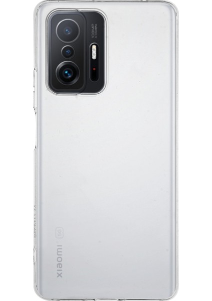 Caseworld Xiaomi Mi 11T Pro Kapak Kamera Korumalı Tıpalı Şeffaf Silikon Kılıf