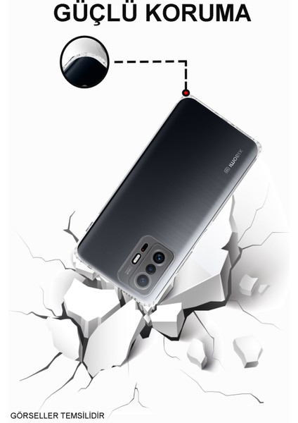 Caseworld Xiaomi Mi 11T Pro Kapak Kamera Korumalı Tıpalı Şeffaf Silikon Kılıf modelleri