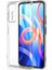 Xiaomi Redmi Note 11 Kılıf Kamera Korumalı Silikon Rubber Arka Kapak 1