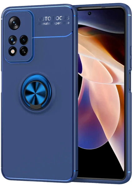 Kip GSM Xiaomi Redmi Note 11 Pro 5g Kılıf Metal Yüzüklü Standlı Yumuşak Ravel Silikon Kapak