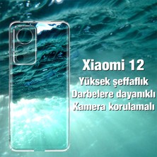 Ally Xiaomi 12 Kılıf Kamera Korumalı Ultra Ince Şeffaf Silikon Kılıf