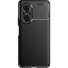 Microcase Huawei Nova 9 Se Maxy Serisi Carbon Fiber Silikon Tpu Kılıf - Siyah