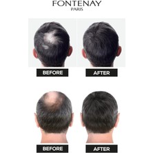 Fontenay Saç Dolgunlaştırıcı Keratin Fibers Açık Kahve Topik Saç Tozu 50GR X2