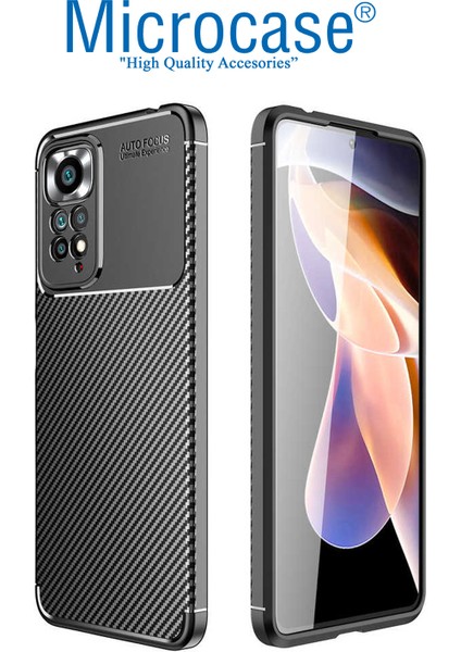 Xiaomi Redmi Note 11 Global Maxy Serisi Carbon Fiber Silikon Tpu Kılıf - Siyah