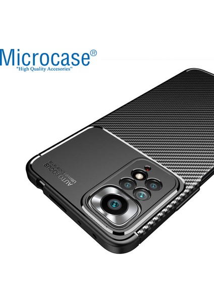 Xiaomi Redmi Note 11 Global Maxy Serisi Carbon Fiber Silikon Tpu Kılıf - Siyah