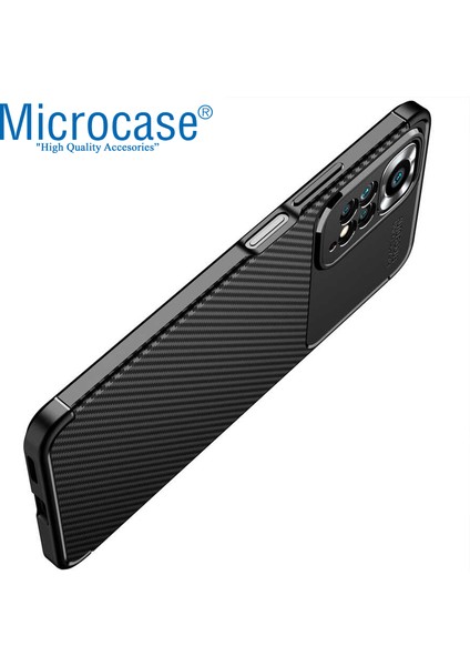 Xiaomi Redmi Note 11 Global Maxy Serisi Carbon Fiber Silikon Tpu Kılıf - Siyah