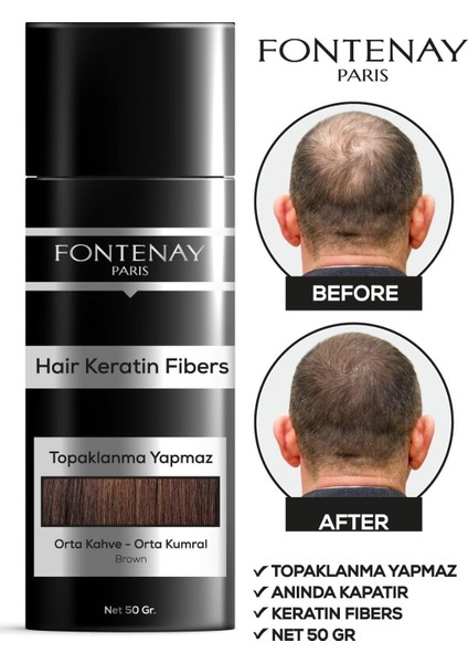 Keratin Fibers Orta Kahve Topik Saç Tozu 50GR X2 fiyatları