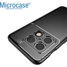 Microcase Oneplus 10 Pro Maxy Serisi Carbon Fiber Silikon Tpu Kılıf - Siyah