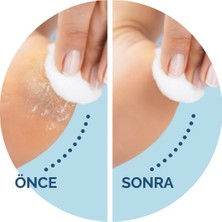 Scholl Velvet Soft Pedikür Ayak Bakım Törpüsü
