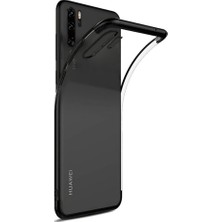 Microcase Huawei P30 Pro Plating Series Silikon Kılıf Siyah