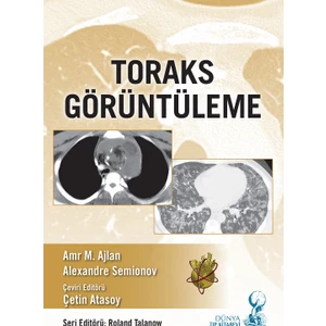 Toraks Görüntüleme - Çetin Atasoy
