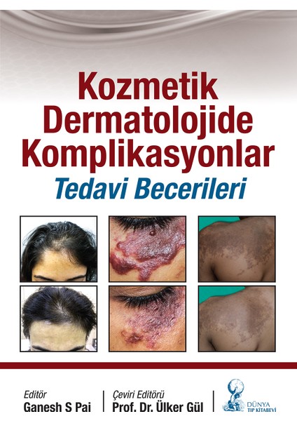 Kozmetik Dermatolojide Komplikasyonlar: Tedavi Becerileri - Ülker Gül