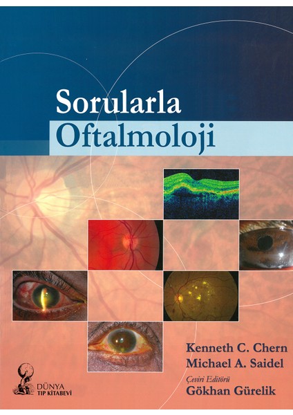 Sorularla Oftalmoloji - Gökhan Gürelik