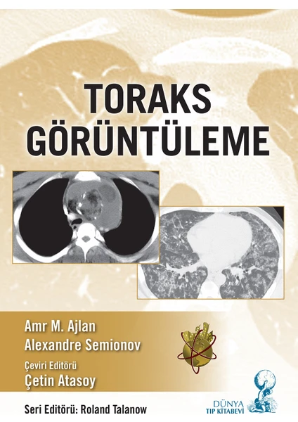 Toraks Görüntüleme - Çetin Atasoy