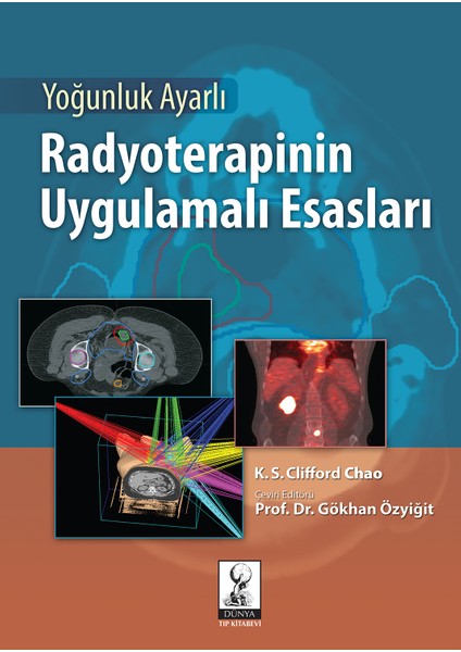 Yoğunluk Ayarlı Radyoterapinin Uygulamalı Esasları - Gökhan Özyiğit
