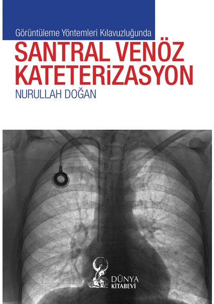 Görüntüleme Yöntemleri Kılavuzluğunda Santral Venöz Kateterizasyon - Nurullah Doğan