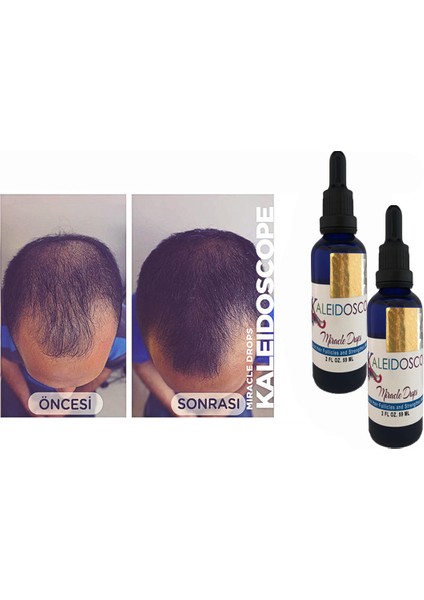 Miracle Drops Hair Oil For Strengthen Weak Hair Unisex Saç Bakım Yağı 4 Adet