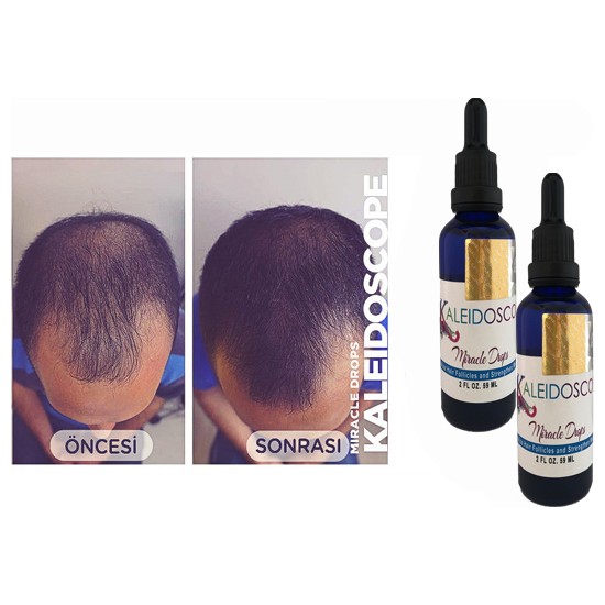Kaleidoscope Miracle Drops Hair Oil For Strengthen Weak Hair Fiyatı