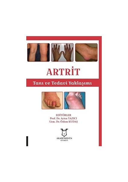 Artrit - Tanı ve Tedavi Yaklaşımı