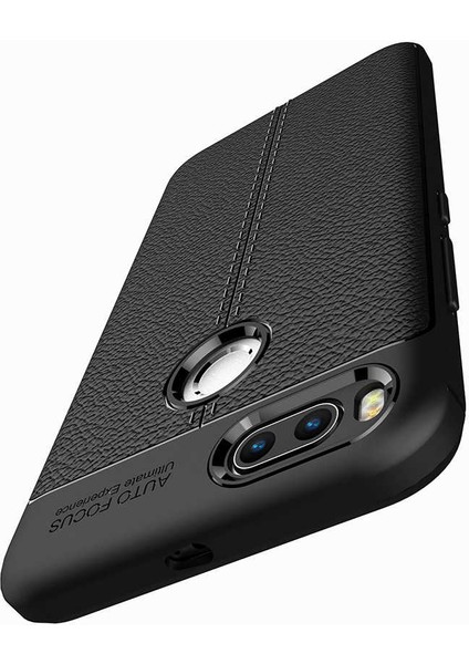 Xiaomi Mi 5x Kılıf Deri Görünümlü Niss Silikon Kapak modelleri