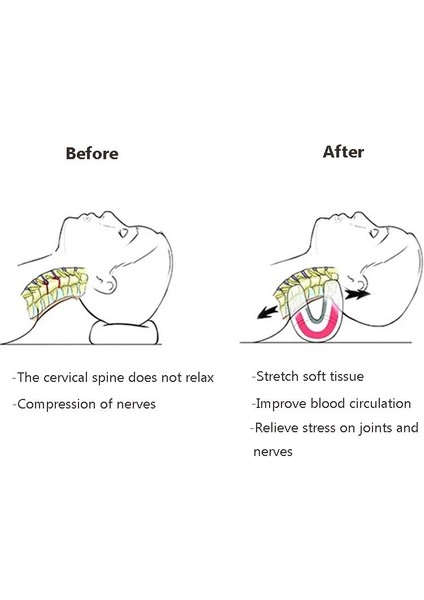 Servikal Omurga Yastığı Germe Masajı (Yurt Dışından) modelleri
