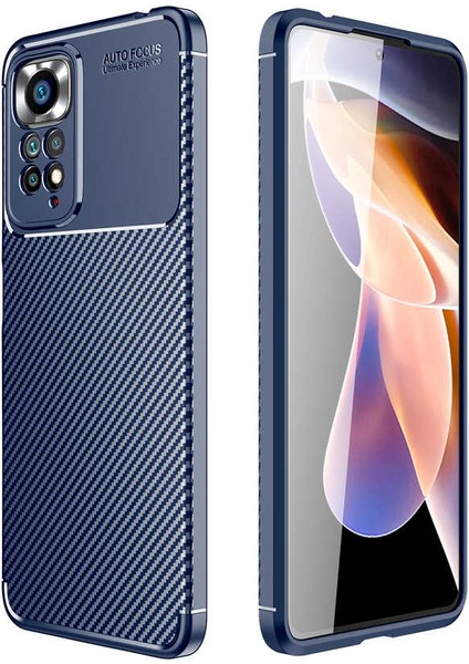 Xiaomi Redmi Note 11S Global Kılıf Karbon Desenli Yüksek Kalite Negro Silikon Kapak