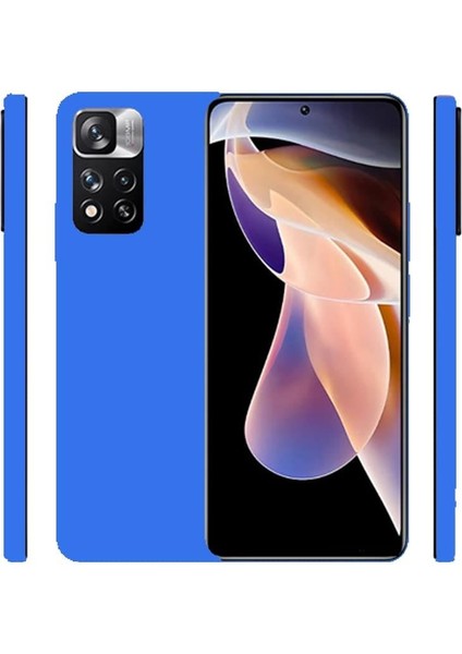 Eco Sense Xıaomı Redmı Note 11 Pro Koyu Ma