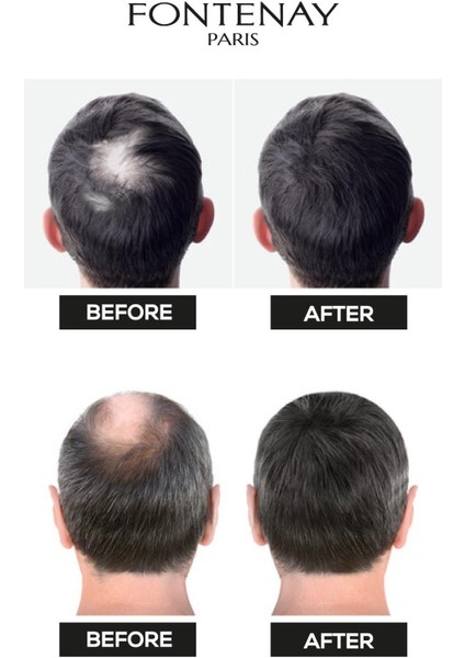 Topik Keratin Fıbers Açık Kahve Topik