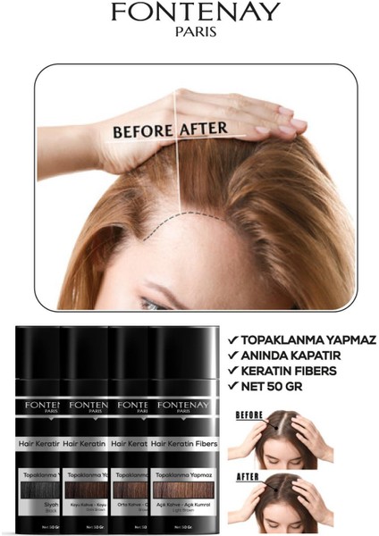 Topik Keratin Fıbers Açık Kahve Topik