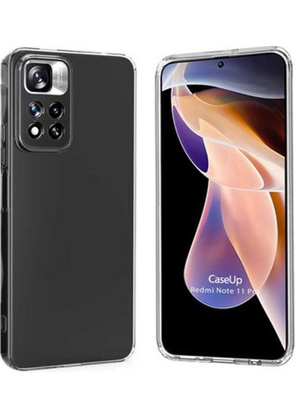 Xiaomi Redmi Note 11 Pro Uyumlu Şeffaf Silikon Kılıf fiyatları