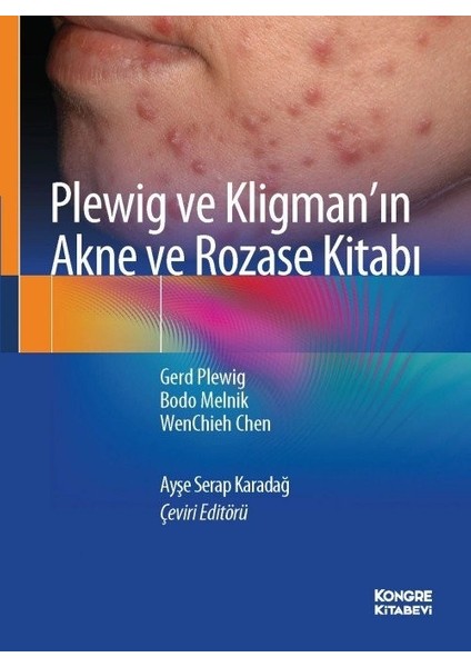 Plewig ve Kligman'ın Akne ve Rozase Kitabı