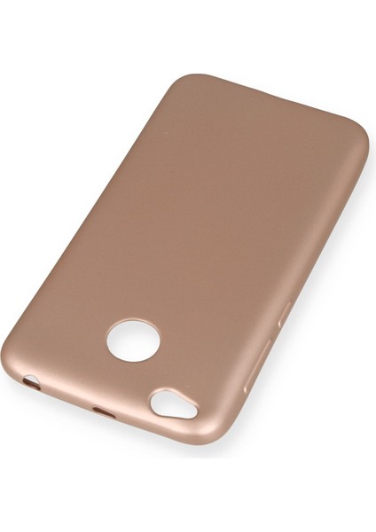 Xiaomi Redmi 4x Kılıf Premium Rubber Silikon - Rose Gold