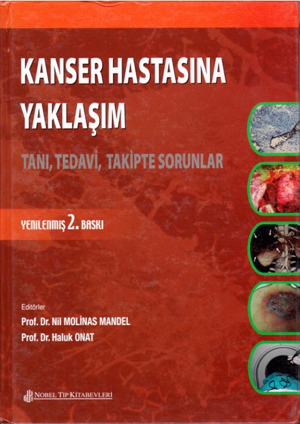 Kanser Hastasına Yaklaşım Tanı, Tedavi, Takipte Sorular