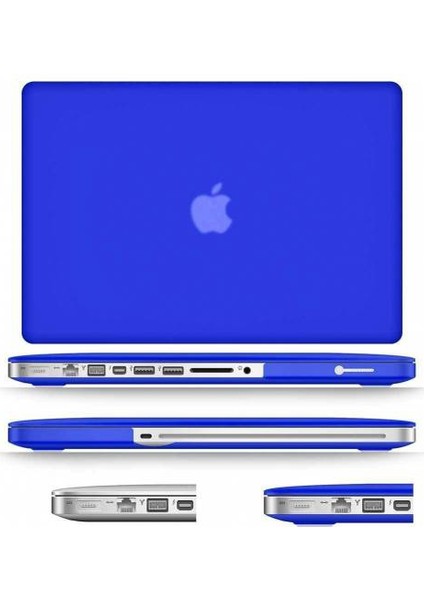 Yeni Macbook Pro 13'' A1706 / A1708 Kılıf Ön Arka Silikon Mat Doku 2016