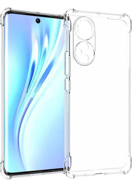 Caseart Honor 50 Kapak Kamera Korumalı Antişok Airbag Köşe Korumalı Silikon Şeffaf Kılıf