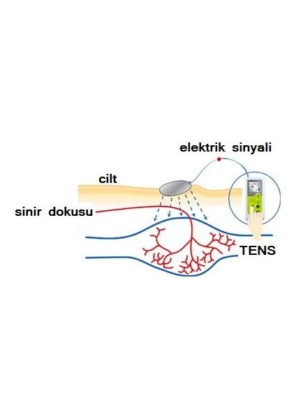 TrendTürk Fizik Tens Masaj Aleti + Terlikli + Elektrotlu