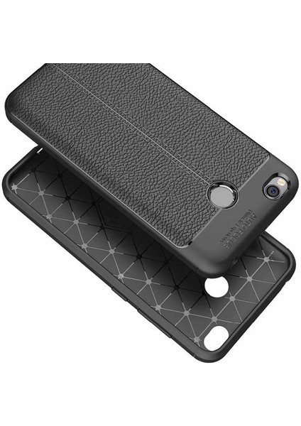 Xiaomi Redmi 4x Kılıf Kamera Korumalı Deri Görünümlü Silikon Kapak modelleri