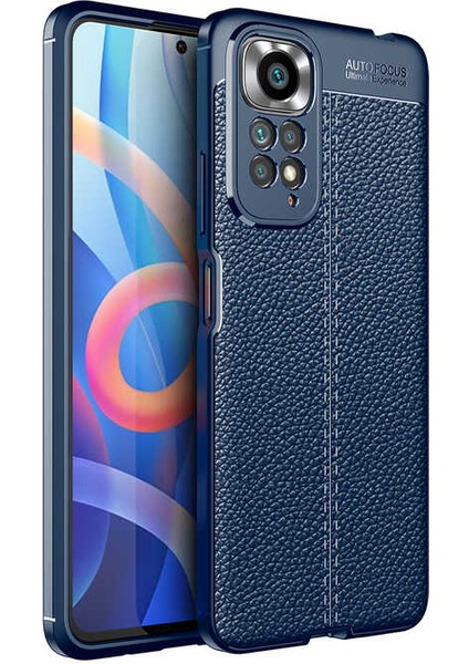 Xiaomi Redmi Note 11S Global Kılıf Kamera Korumalı Deri Görünümlü Silikon Kapak