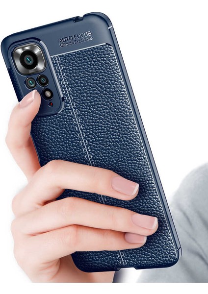 Xiaomi Redmi Note 11S Global Kılıf Kamera Korumalı Deri Görünümlü Silikon Kapak