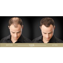 Toppik Hair Building Fibers 27,5 gr. Saç Fiberi Gri