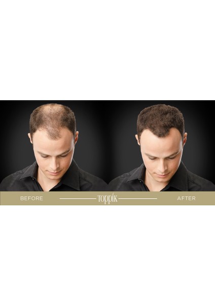 Hair Building Fibers 27,5 gr. Saç Fiberi Siyah